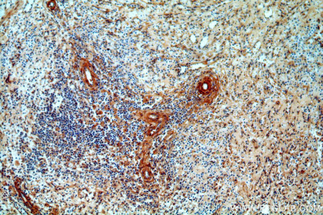 p75NTR Antibody in Immunohistochemistry (Paraffin) (IHC (P))