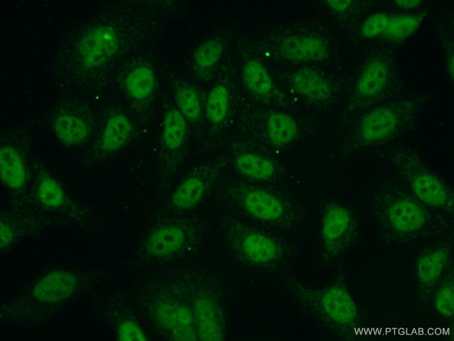 NBS1 Antibody in Immunocytochemistry (ICC/IF)