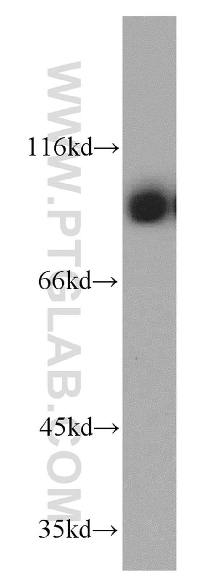 NBS1 Antibody in Western Blot (WB)