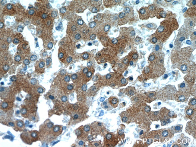 B3GALT6 Antibody in Immunohistochemistry (Paraffin) (IHC (P))