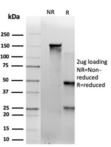 SAMD4B (Transcription Factor) Antibody in SDS-PAGE (SDS-PAGE)