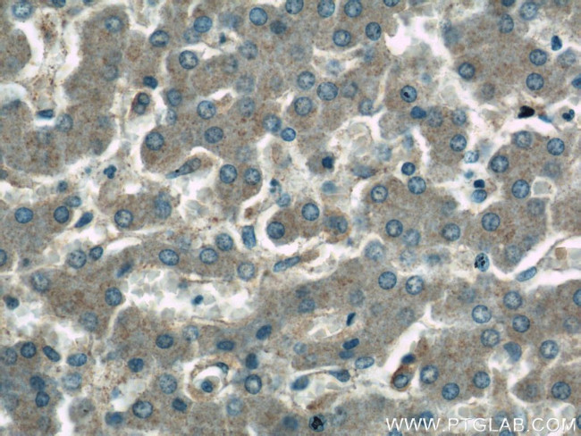 GDI2 Antibody in Immunohistochemistry (Paraffin) (IHC (P))