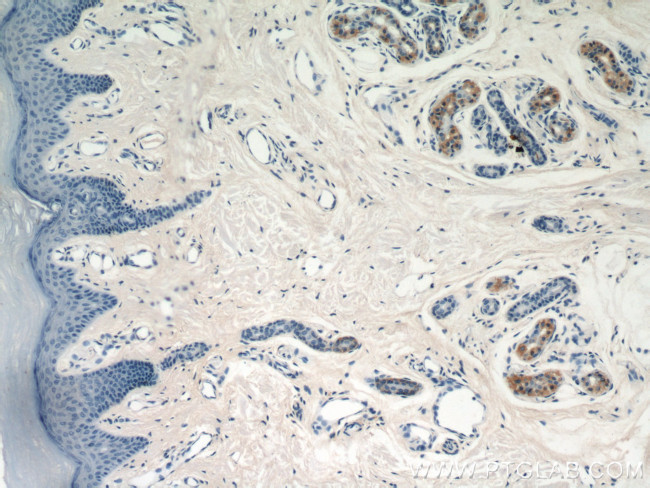 GDI2 Antibody in Immunohistochemistry (Paraffin) (IHC (P))