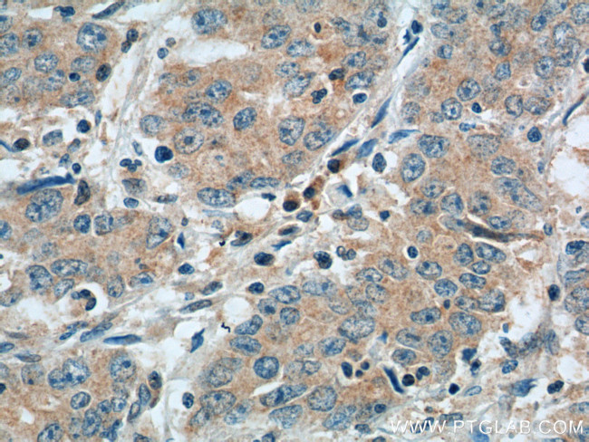 NPR1 Antibody in Immunohistochemistry (Paraffin) (IHC (P))