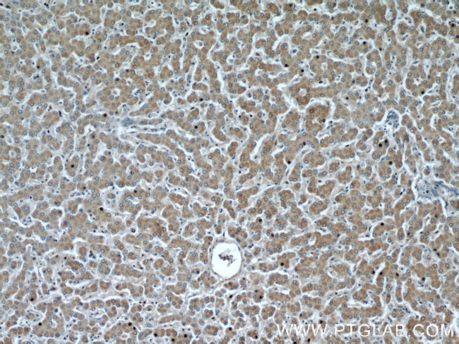 NUDT19 Antibody in Immunohistochemistry (Paraffin) (IHC (P))