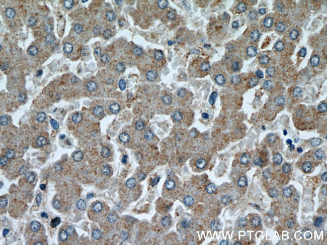 NUDT19 Antibody in Immunohistochemistry (Paraffin) (IHC (P))