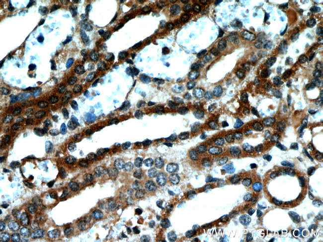 NUDT19 Antibody in Immunohistochemistry (Paraffin) (IHC (P))