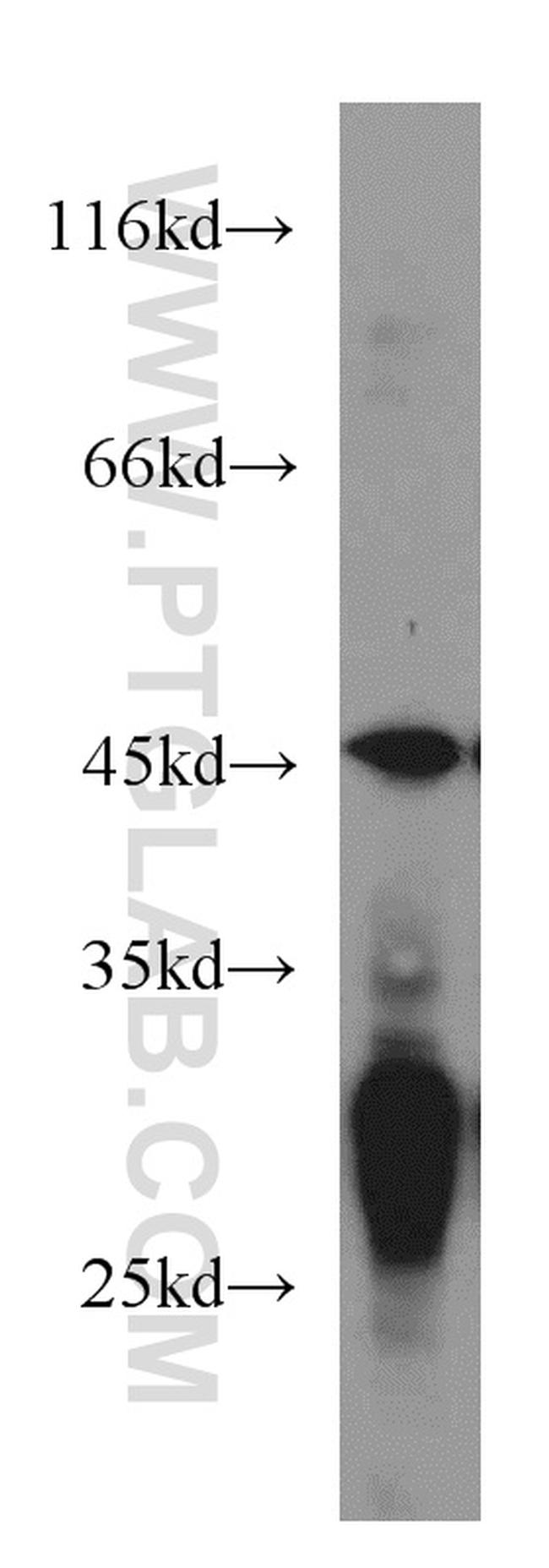 NUDT19 Antibody in Western Blot (WB)