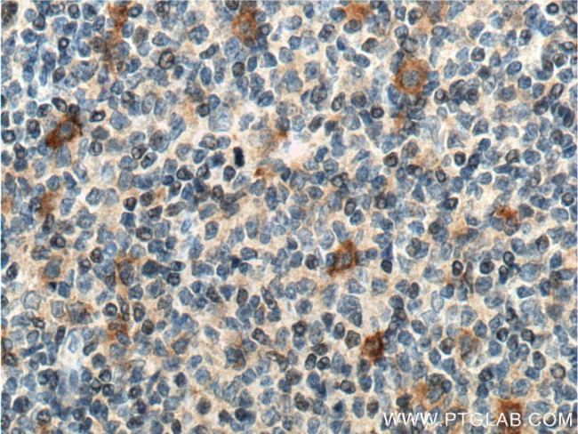 CD30 Antibody in Immunohistochemistry (Paraffin) (IHC (P))