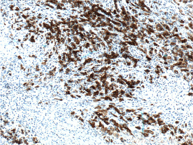 CD30 Antibody in Immunohistochemistry (Paraffin) (IHC (P))