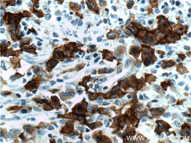 CD30 Antibody in Immunohistochemistry (Paraffin) (IHC (P))