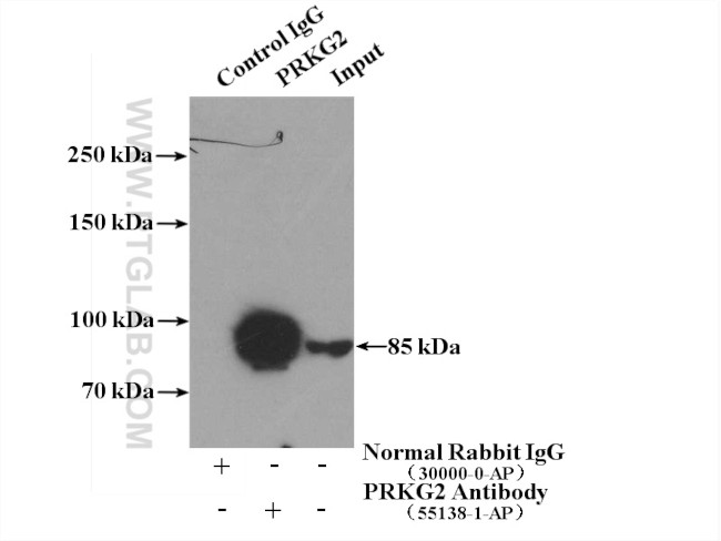 PRKG2 Antibody in Immunoprecipitation (IP)