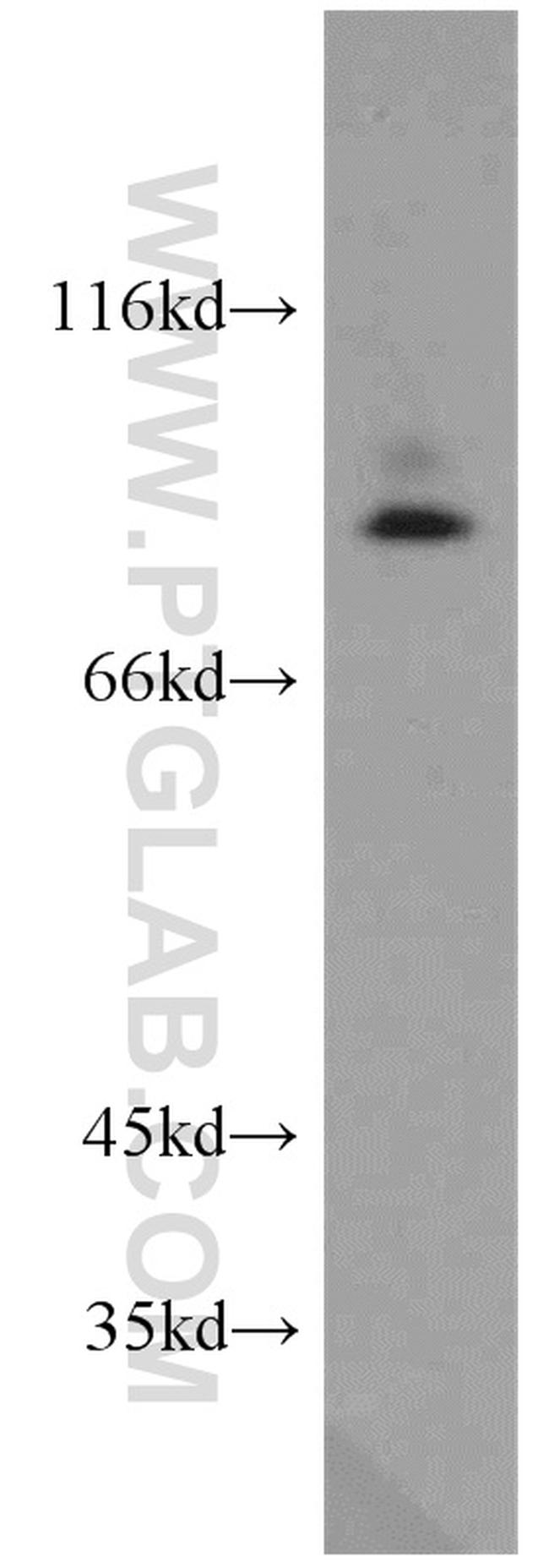 PRKG2 Antibody in Western Blot (WB)