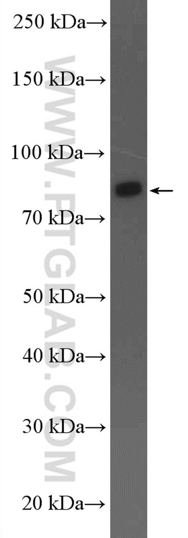 ARHGAP10 Antibody in Western Blot (WB)