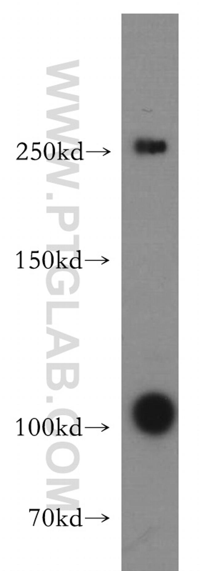 TAF1L Antibody in Western Blot (WB)