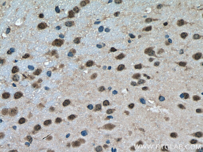 PTBP2 Antibody in Immunohistochemistry (Paraffin) (IHC (P))