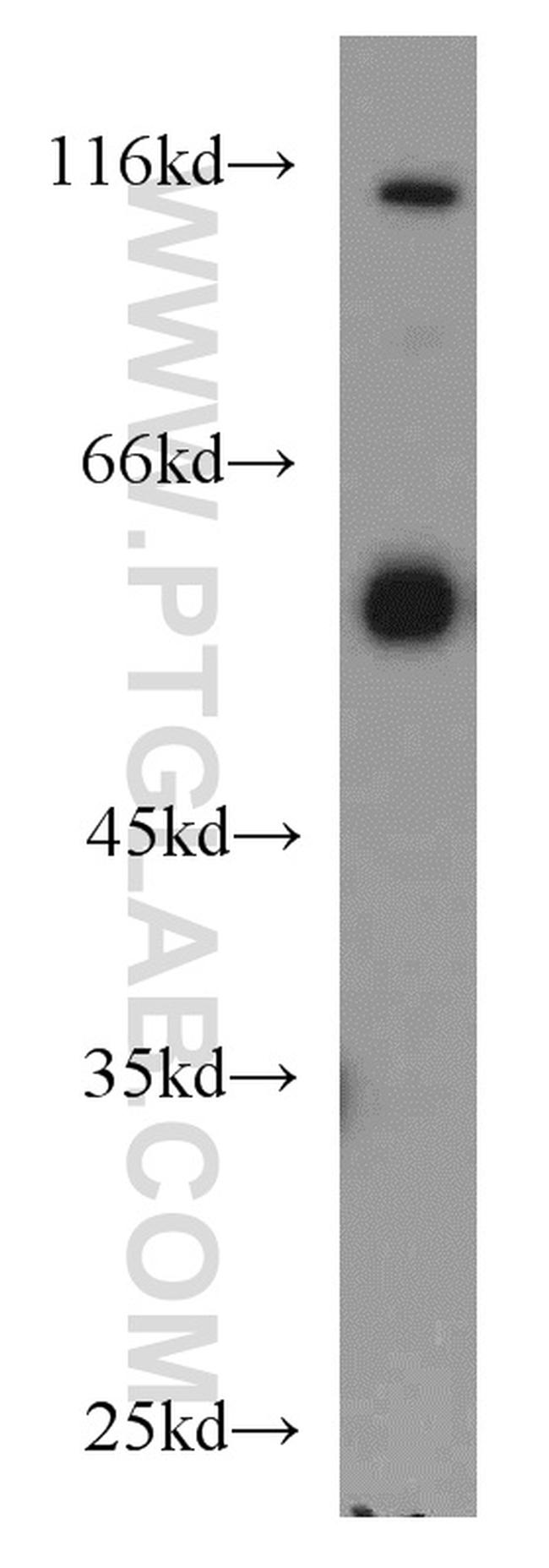 PTBP2 Antibody in Western Blot (WB)