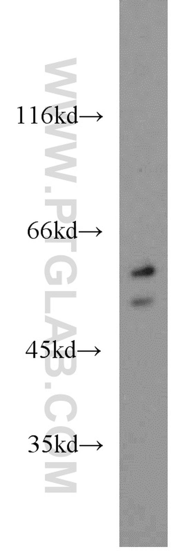 PTBP2 Antibody in Western Blot (WB)