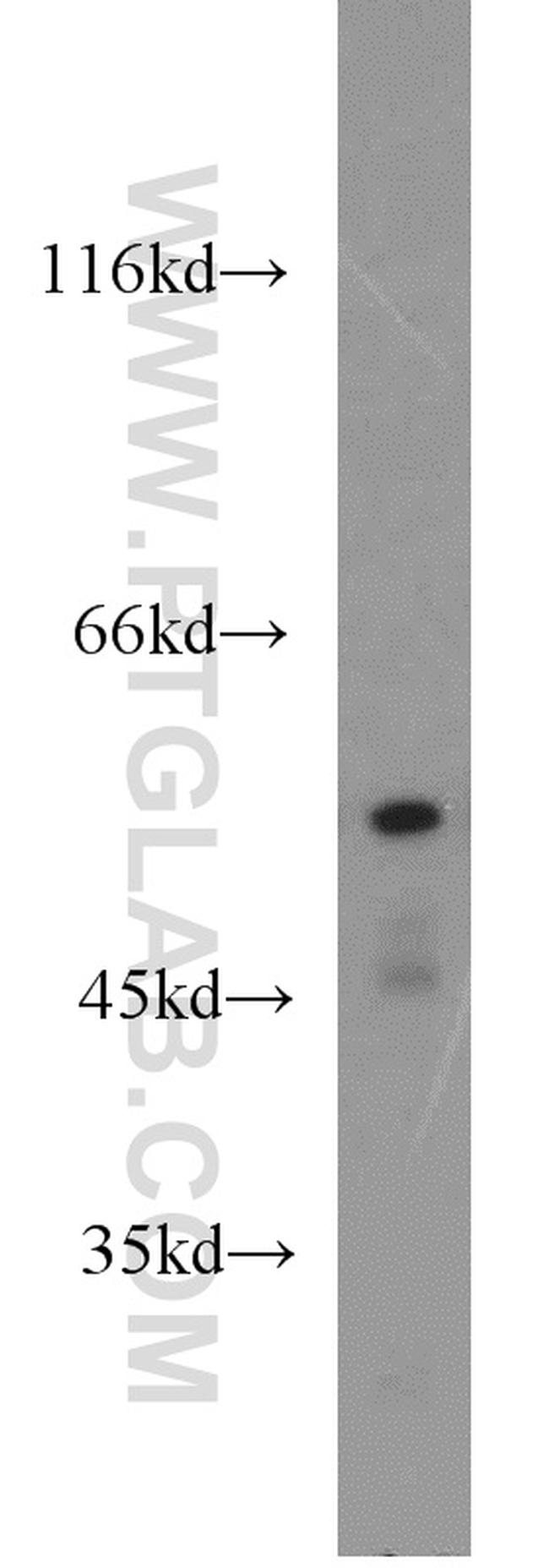 PTBP2 Antibody in Western Blot (WB)