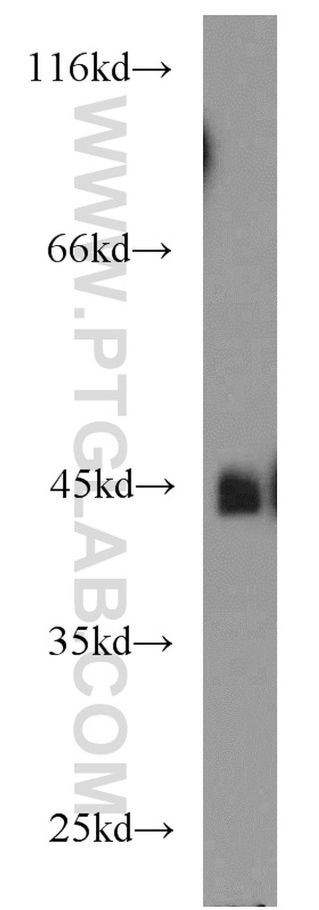 MBD2 Antibody in Western Blot (WB)