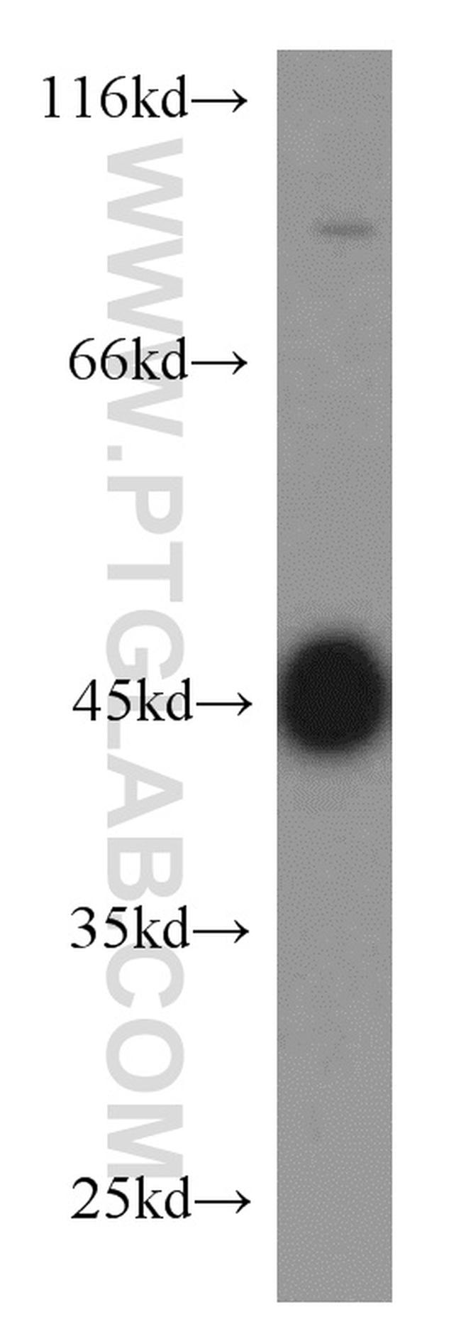 MBD2 Antibody in Western Blot (WB)