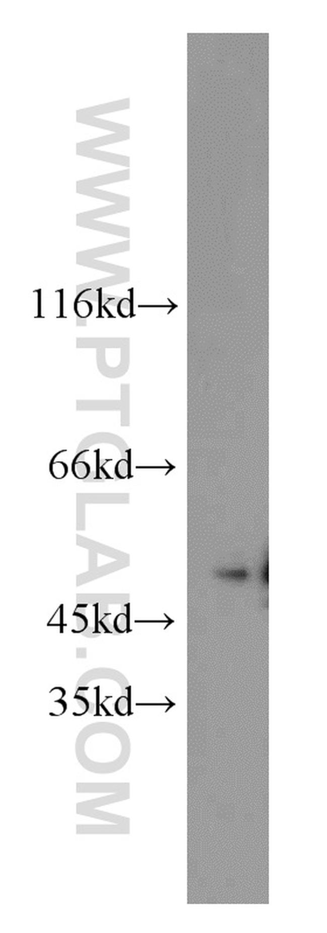 MBD2 Antibody in Western Blot (WB)