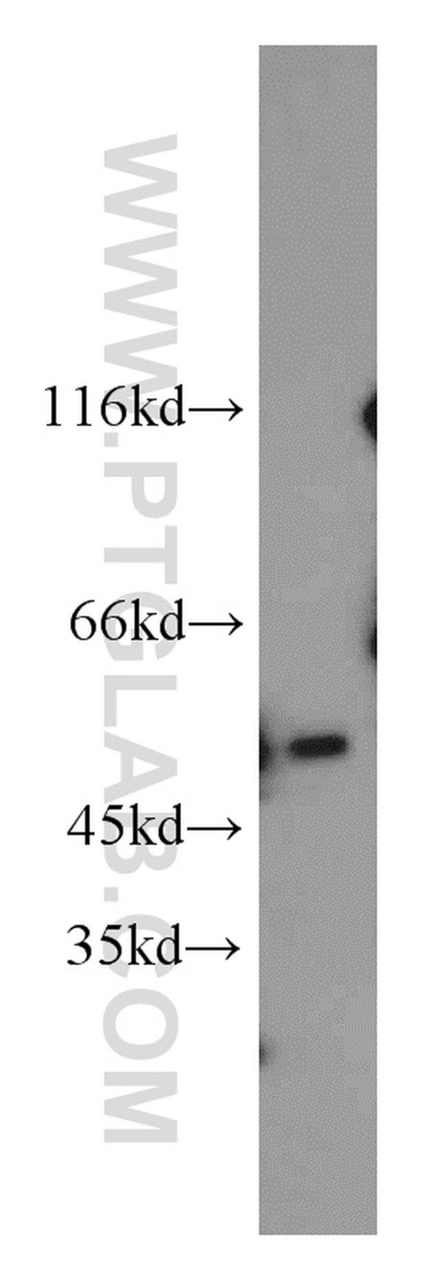 MBD2 Antibody in Western Blot (WB)