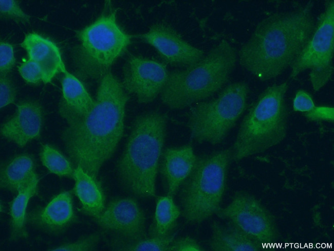 L-Plastin Antibody in Immunocytochemistry (ICC/IF)