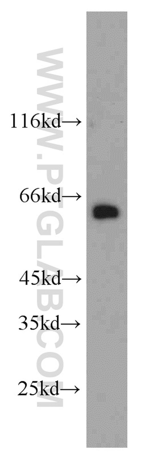 L-Plastin Antibody in Western Blot (WB)