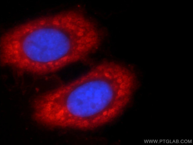 ENO1 Antibody in Immunocytochemistry (ICC/IF)