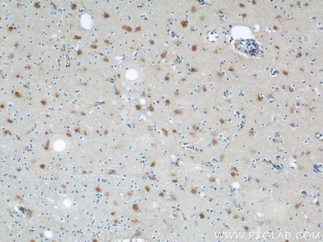 ENO1 Antibody in Immunohistochemistry (Paraffin) (IHC (P))