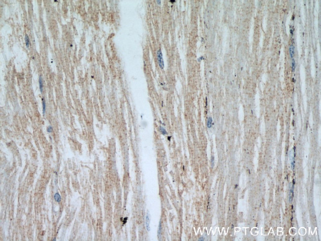 ENO1 Antibody in Immunohistochemistry (Paraffin) (IHC (P))