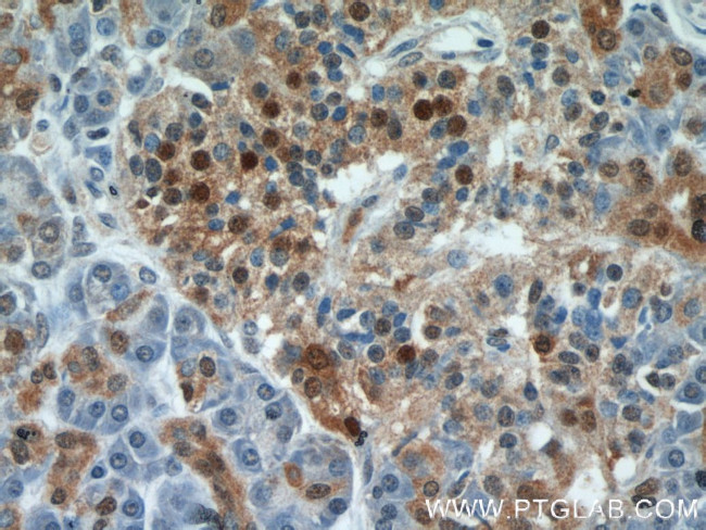 ENO1 Antibody in Immunohistochemistry (Paraffin) (IHC (P))