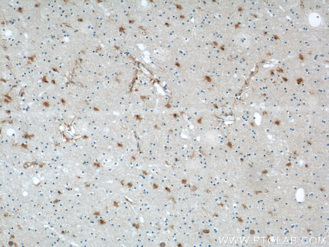 ENO1 Antibody in Immunohistochemistry (Paraffin) (IHC (P))