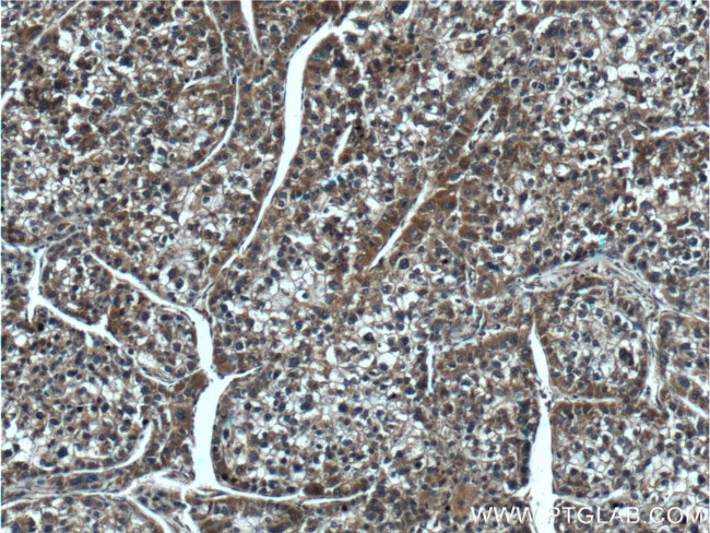 PARVA Antibody in Immunohistochemistry (Paraffin) (IHC (P))