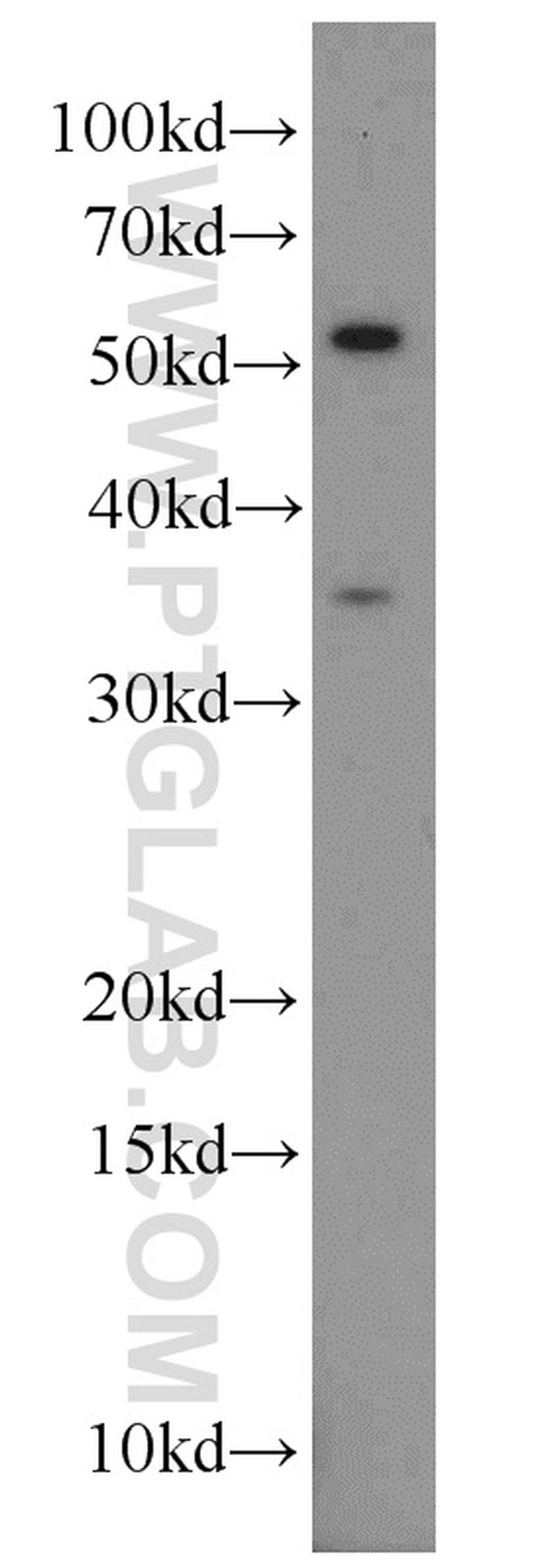 PARVA Antibody in Western Blot (WB)