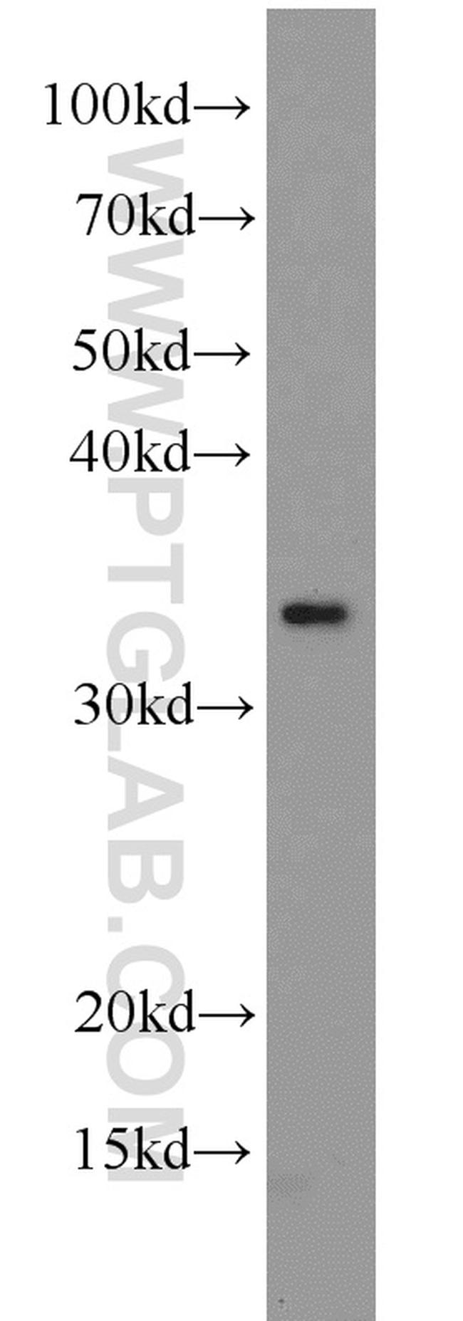 PARVA Antibody in Western Blot (WB)