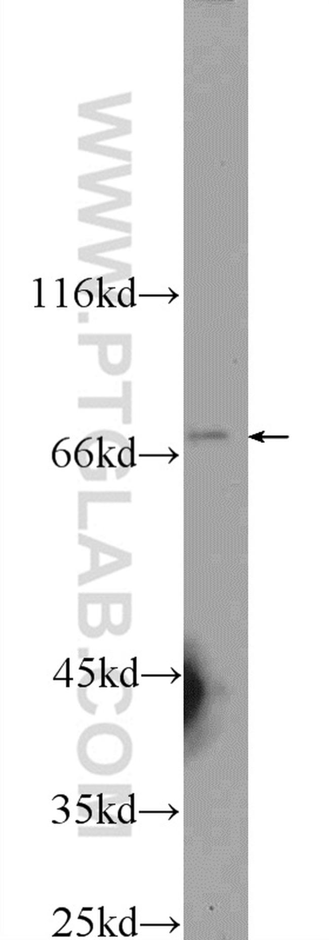MMP21 Antibody in Western Blot (WB)
