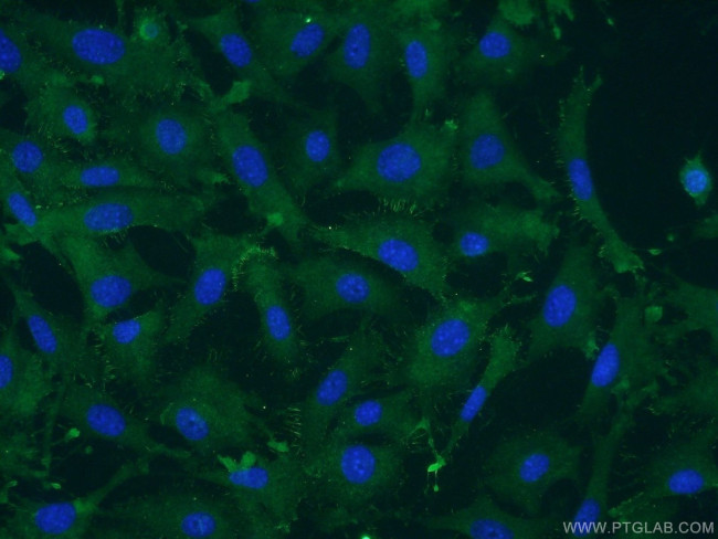 RAB8A Antibody in Immunocytochemistry (ICC/IF)