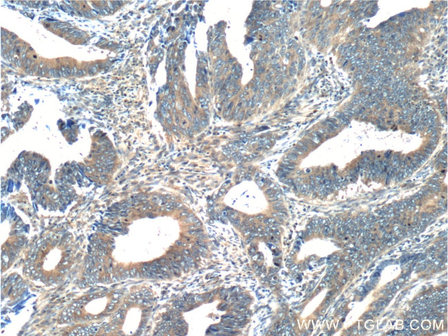 RAB8A Antibody in Immunohistochemistry (Paraffin) (IHC (P))