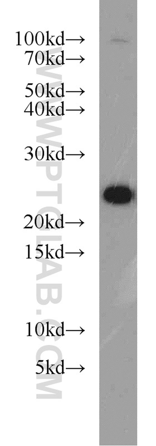 RAB8A Antibody in Western Blot (WB)