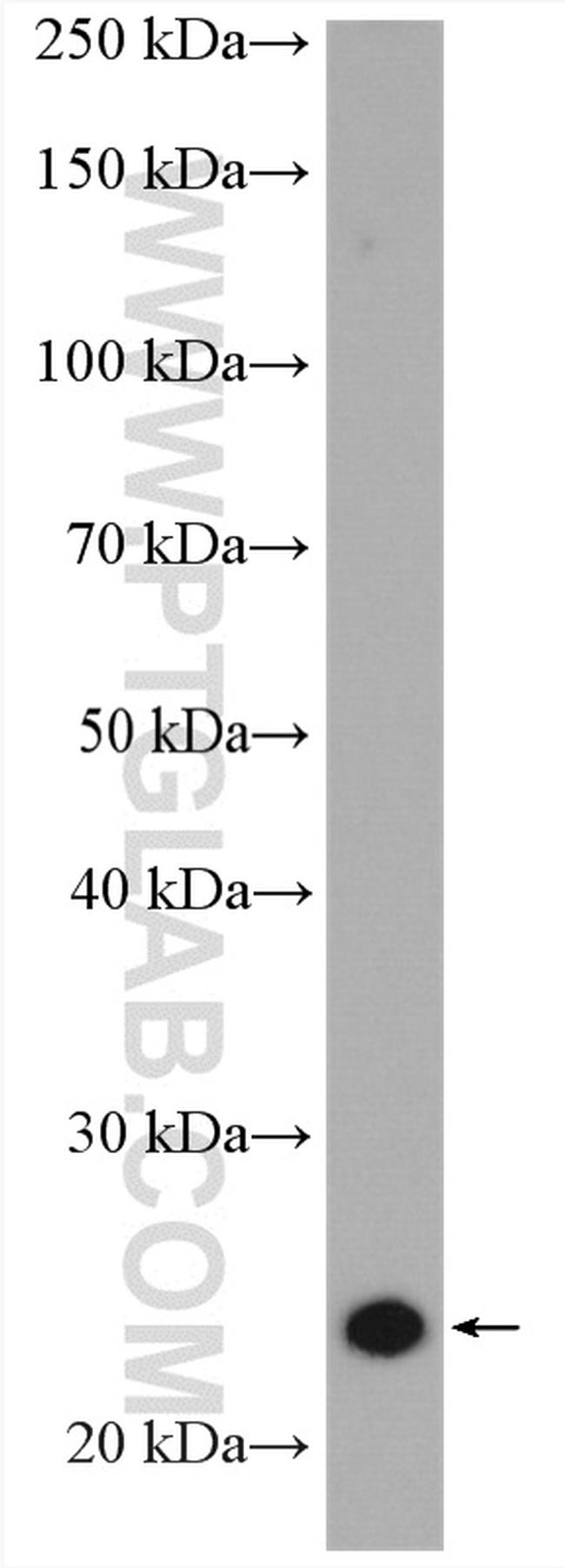 RAB8A Antibody in Western Blot (WB)