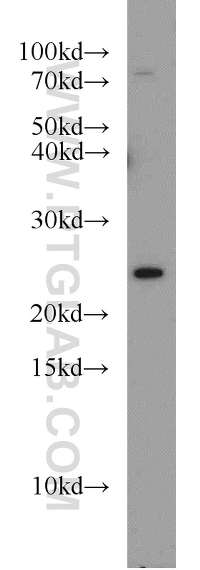 RAB8A Antibody in Western Blot (WB)