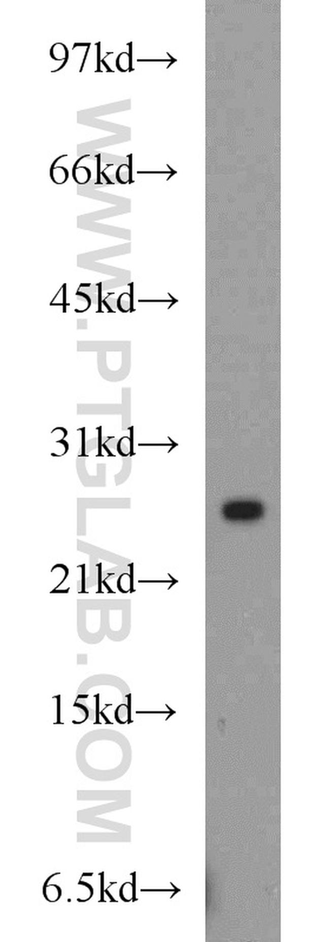 RAB8A Antibody in Western Blot (WB)