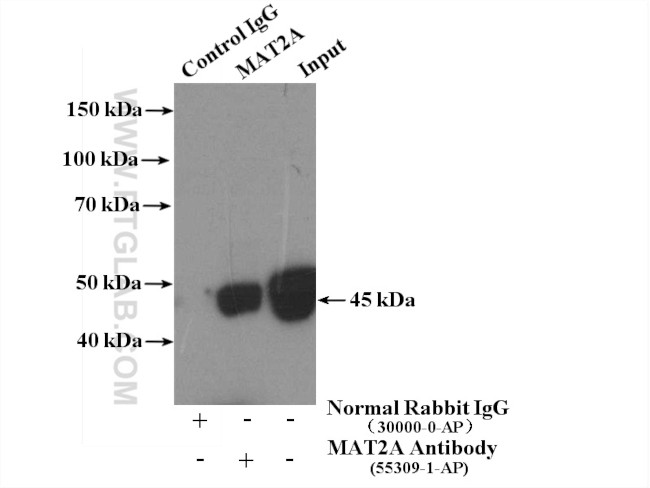 MAT2A Antibody in Immunoprecipitation (IP)