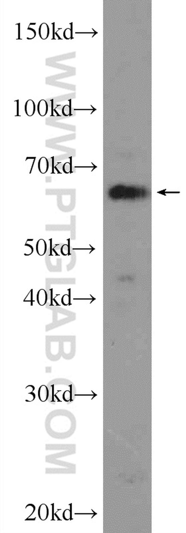 TBL1XR1 Antibody in Western Blot (WB)