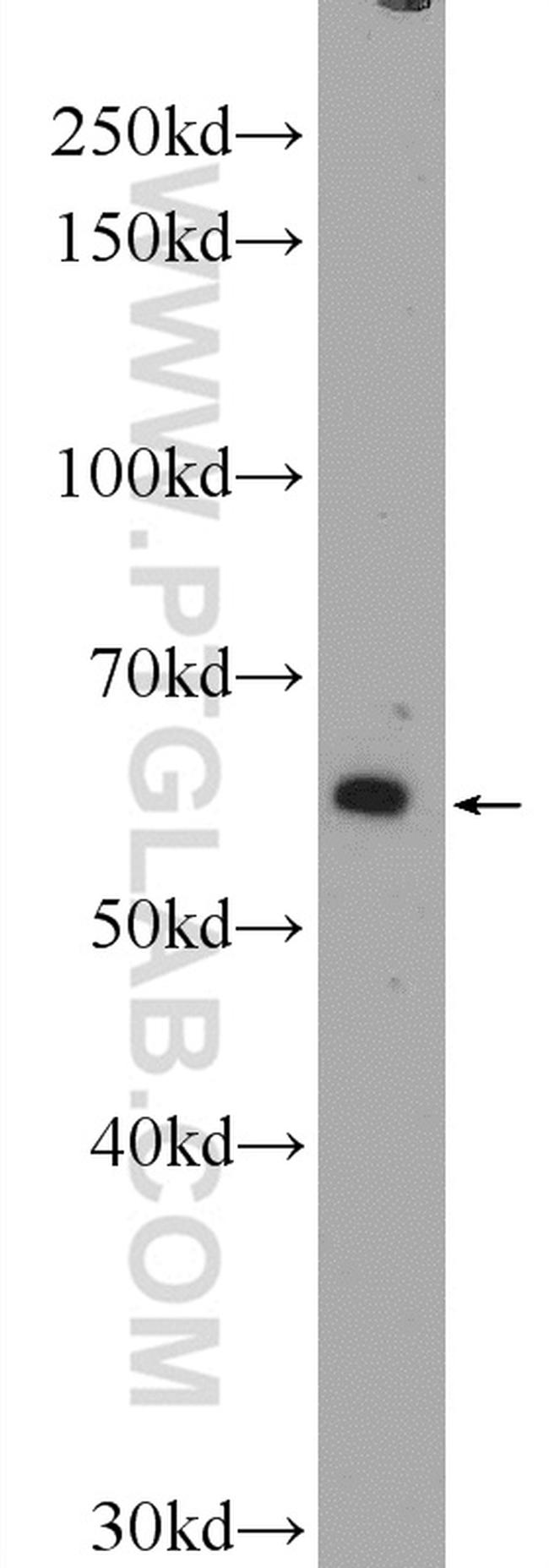 TBL1XR1 Antibody in Western Blot (WB)