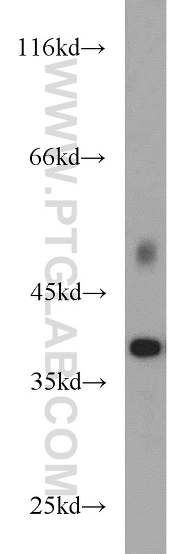 PKA C-beta Antibody in Western Blot (WB)