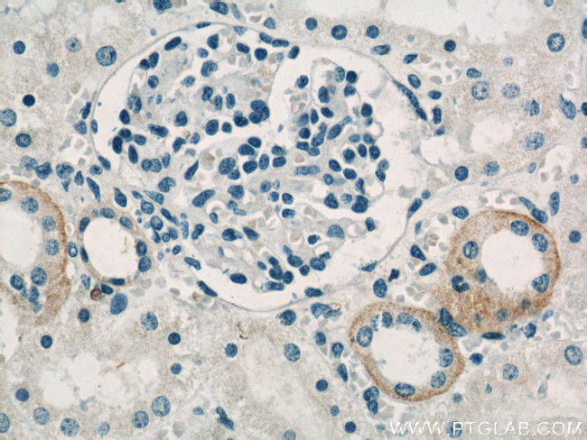 PKA C-beta Antibody in Immunohistochemistry (Paraffin) (IHC (P))