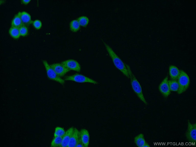 FAM13A Antibody in Immunocytochemistry (ICC/IF)